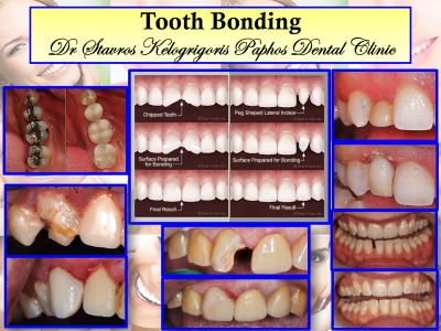 DrStavros Kelogrigoris Paphos Dental Clinic